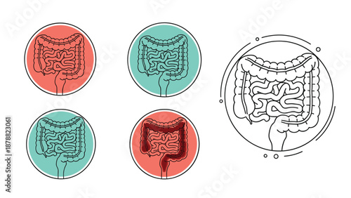 Medical icon set of the human large intestine and colon, showing healthy and inflamed states for digestive health and gastroenterology concepts.