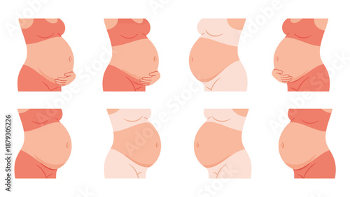 Pregnant Belly Stages Collection Vector Illustration
