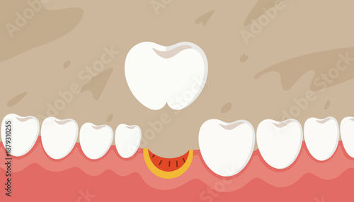 Close-up on teeth erosion from smoking 
