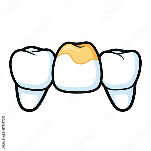 A cartoon illustration of three teeth