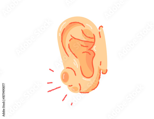 illustration of an ear with a large lump. boils or pimples on the ears. Ear diseases and health problems. human ear. crayon outline flat style illustration. symbols, stickers, clip art, elements.