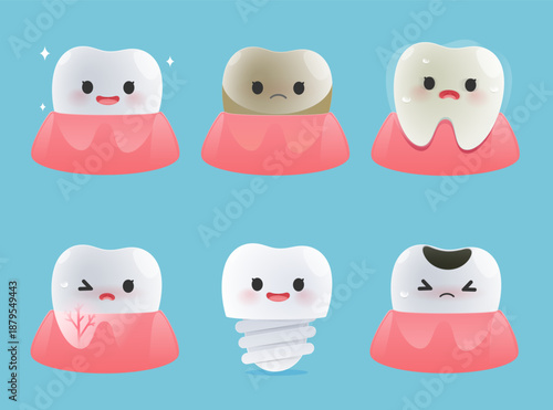 Cute dental cartoon set showing clean tooth, tartar, loose tooth, inflammation, implant, and decay encouraging regular checkups and better oral health habits. Illustrated oral health care concept.