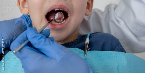 Tableau sur toile Dentist examining child's teeth with mirror, treatment process in pediatric clin
