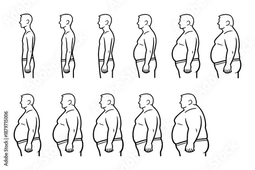 Male weight gain progression over time: side profile illustrations