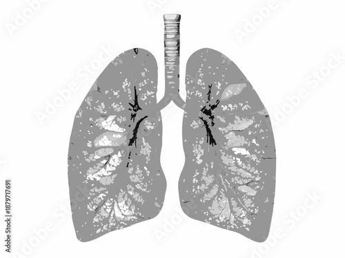 Anatomical illustration of human lungs showcasing bronchial tree and pulmonary structure