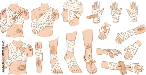 First aid bandaging and injury treatment set showing wrapped body parts, wounds, and medical care procedures in flat vector illustration