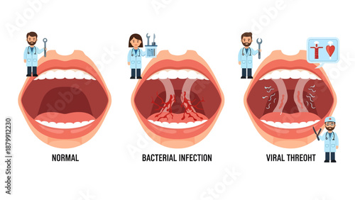 Throat Conditions Normal Infection Viral Threat.