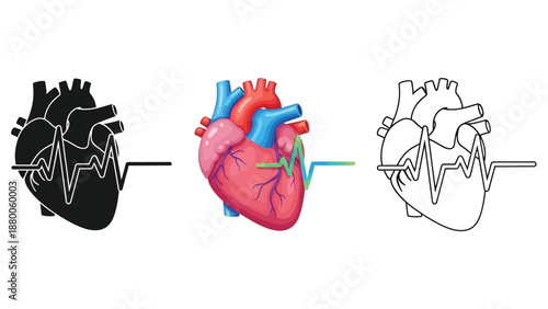 Human heart anatomical illustration with electrocardiogram lines shown in three different styles