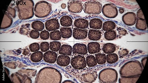 Intricate histological slide showcasing a biological specimen under 200x magnification highlighting various cellular components and distinct brown rounded formations indicative of a parasitic infecti.