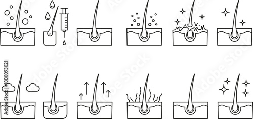 Hair follicle care stages, black and white vector, scalp treatment process, exfoliation hydration injection, dermatology concept illustration design