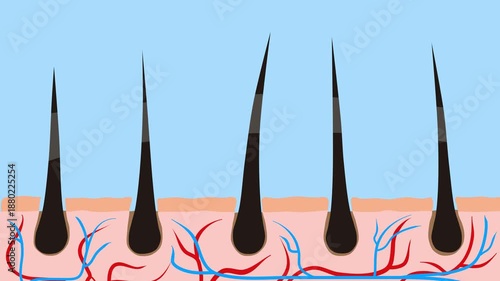 2D Hair Growth Animation on Scalp with Follicle Concept, Hair care, hair growth oil drop to root, Animation Nourish hair action of shampoo or serum