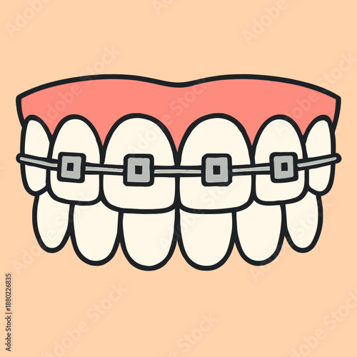 Orthodontic braces on teeth flat vector