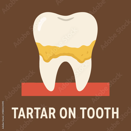 Plaque and tartar buildup on teeth