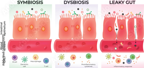 Leaky Gut Syndrome Normal
