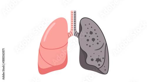 Illustration of human lungs, one healthy and one diseased, showcasing anatomy and respiratory health from a medical viewpoint