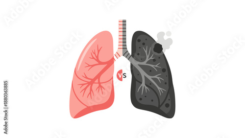 Detailed anatomical illustration of human lungs with trachea and bronchi, showcasing respiratory system and internal structures