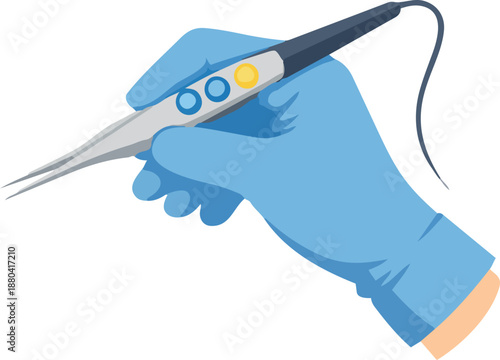 A blue-gloved hand holds an electric surgical forceps with control buttons and a cable against a black background in a flat medical illustration