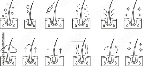 Hair follicle treatment process, black and white medical illustration, hair care steps, scalp therapy diagram, grooming procedure infographic, follicle health stages