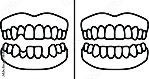 A Set of Missing Teeth alongside a Set of Full Human Teeth Icon in Outline Style