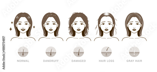 Cartoon-style comparison of five hair conditions with scalp diagrams and expressive faces.