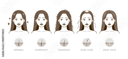 Cartoon-style comparison of five hair conditions with scalp diagrams and expressive faces.