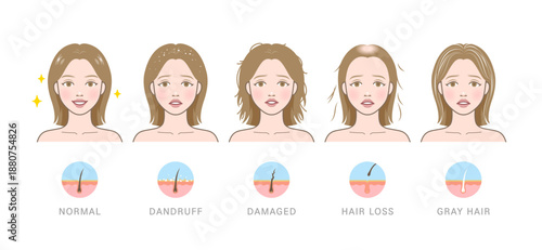Cartoon-style comparison of five hair conditions with scalp diagrams and expressive faces.