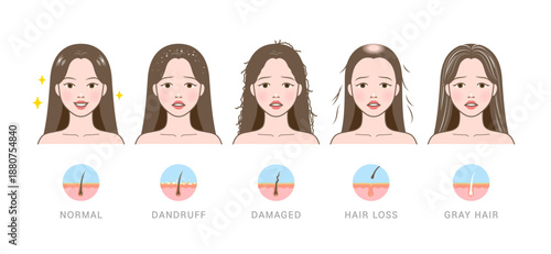 Cartoon-style comparison of five hair conditions with scalp diagrams and expressive faces.