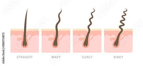 Human skin cross section with hair follicle anatomy showing epidermis, dermis, glands and blood vessels, medical diagram.
