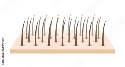 Graphical cross-section of human skin with embedded hair follicles and natural hair color variation.