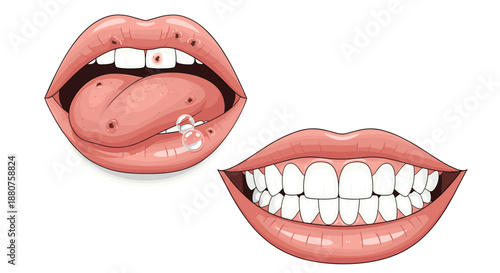 Comparison between a mouth with multiple painful sores on the tongue and lips and a healthy, bright white smile with healthy gums.