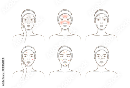 Various female facial skin problems including acne, redness, dryness, freckles and irritation skin conditions.