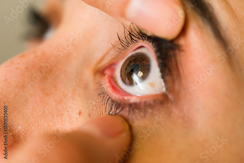 Doctor performing eye exam on patient, checking vision and health, with hands holding eyelid open