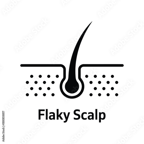 Illustration of a hair follicle with visible flakiness on the scalp surface