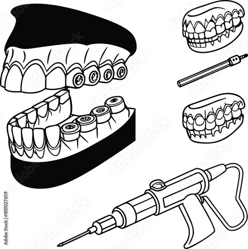 Dental implants and oral surgery tools illustration