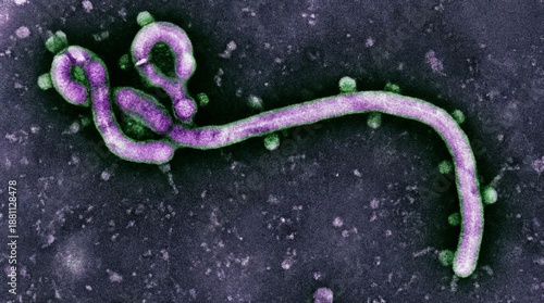 Microscopic view of Ebola virus filament structure