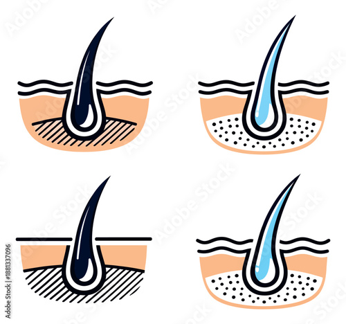 Modern line art hair follicle icons set featuring hair loss, growth, and treatment for dermatology and hair care products