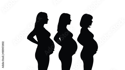 Three pregnant women's silhouettes show the progression of pregnancy.
