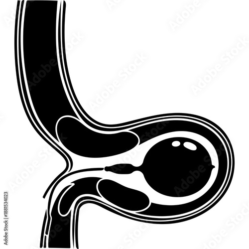 Aorta and IABP Mechanism Silhouette Icon