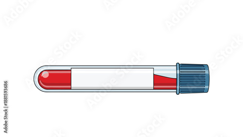 Medical test tube containing a red blood sample with a blank white label for diagnostic laboratory results.