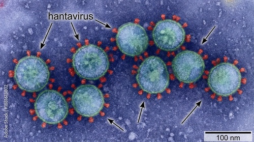 Electron microscope view of Hantavirus particles with structural labels