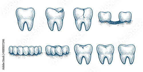 Collection of hand-drawn tooth illustrations with various dental conditions
