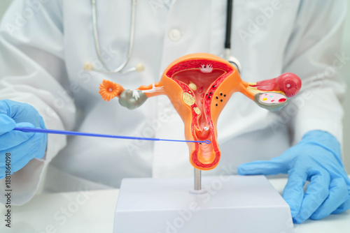 Uterus, doctor holding human anatomy model for study diagnosis and treatment in hospital.