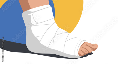 Medical illustration of a human foot and ankle wrapped in a white bandage or cast, representing injury, recovery, and healthcare.