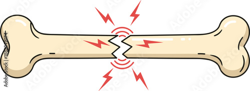 Broken bone with jagged fracture and pain symbols, cartoon injury icon – flat vector illustration