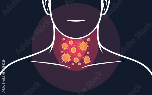 Illustration of a person experiencing throat infection with highlighted viral particles around the neck area from a front viewpoint