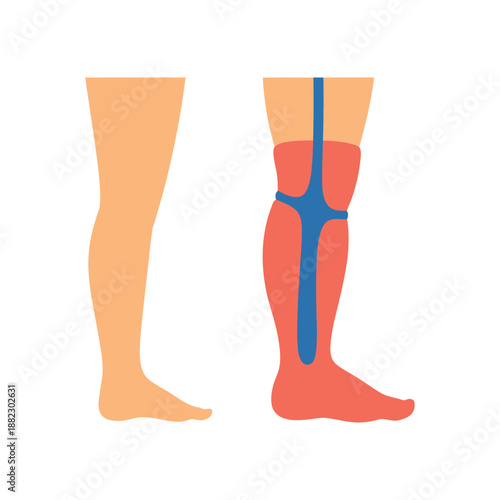Anatomical illustration of a human leg with and without highlighted veins and muscles