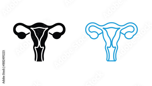 A graphic illustration of the female reproductive system with uterus and ovaries