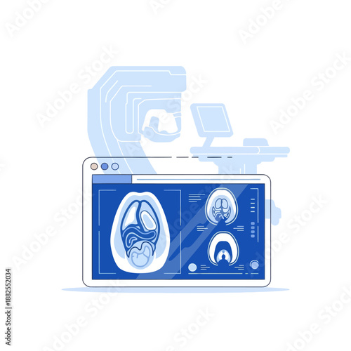 Medical Scan Illustration: MRI Machine and Brain CT Scan Display