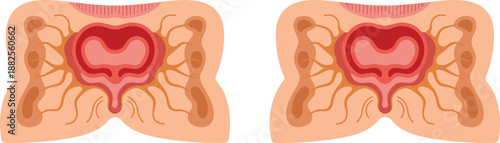 Anatomical Cross Section Illustration of Human Prostate Gland and Urinary System Showing Internal Structures for Medical Education and Healthcare Graphic Design