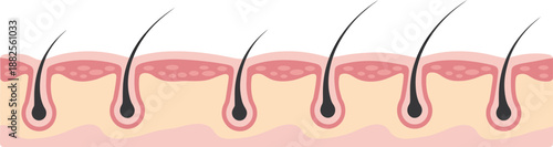 Anatomical cross section of human skin showing various hair growth stages, dermis layers, epidermis, and hair follicles for dermatology medical education